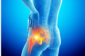hip-pain .jpg